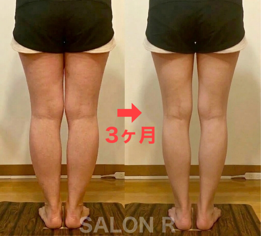 足痩せ/下半身痩せ/つくば