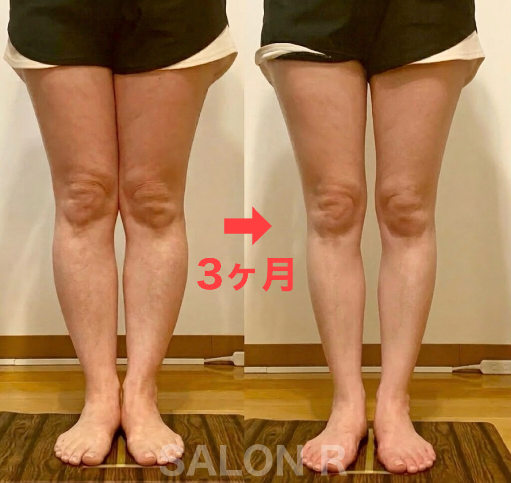脚痩せ/下半身太り/つくば